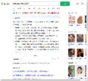 赶集时金镯被剪断手臂流血_360搜索